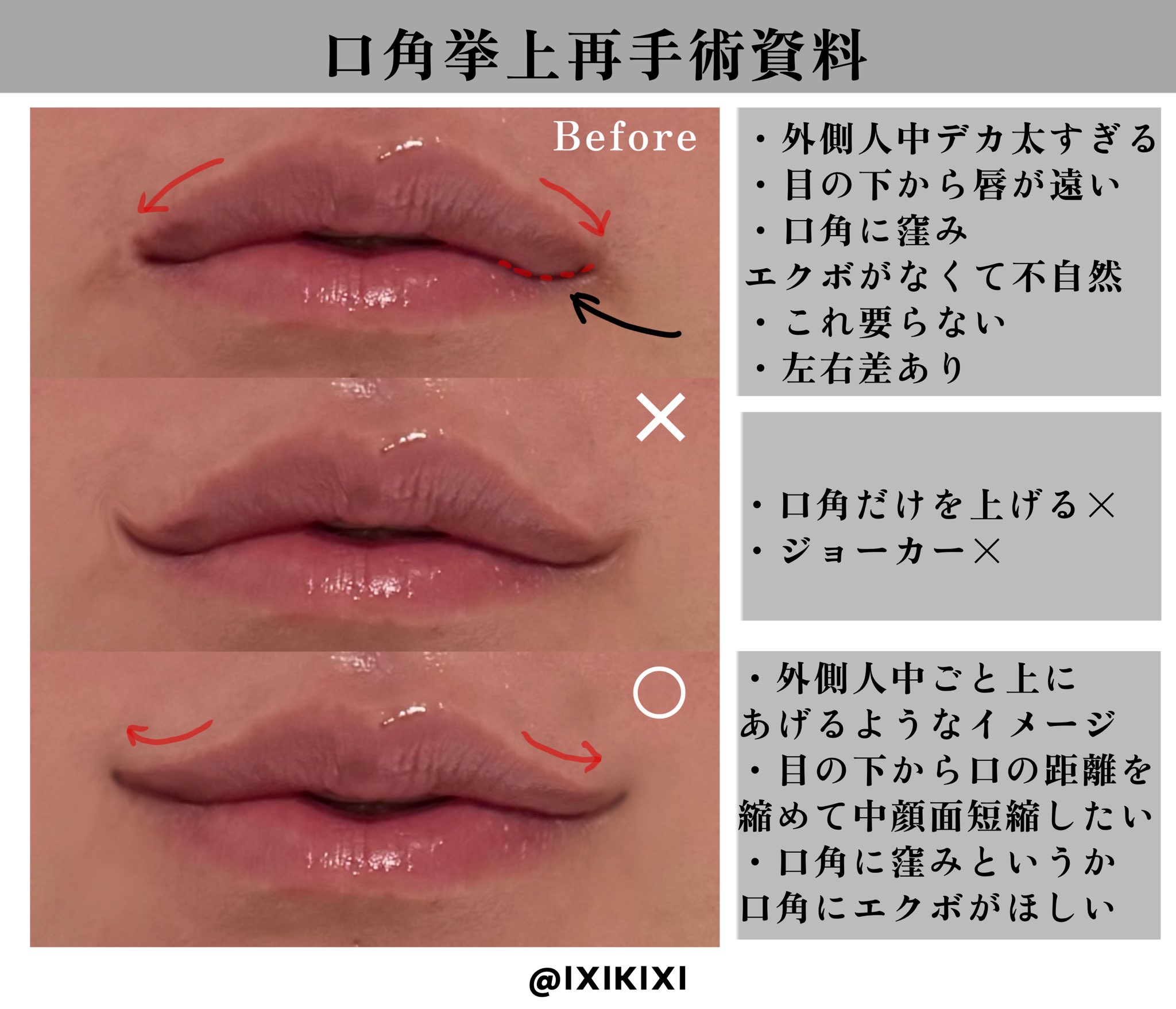 入手不可能！1993年のサンチェ 整形前は希少！ （韓流・K-POP