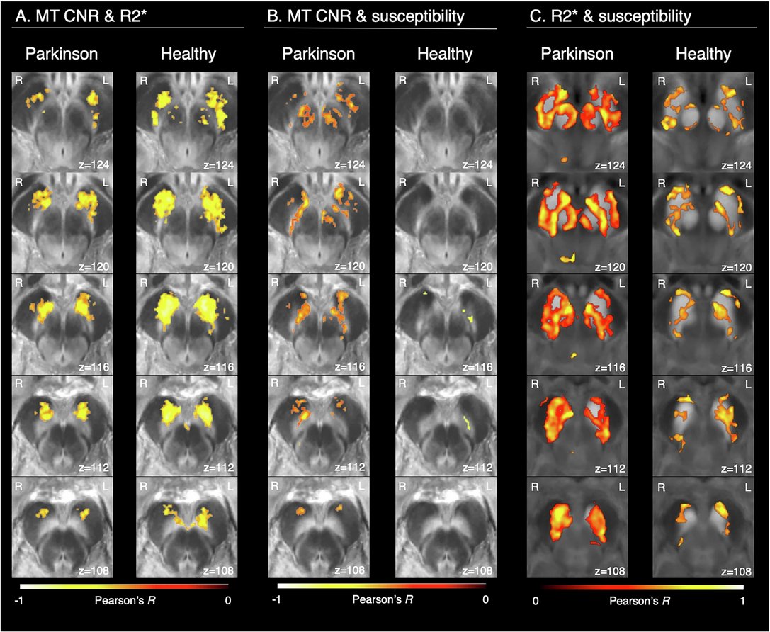 The Science of Parkinson's tweet media