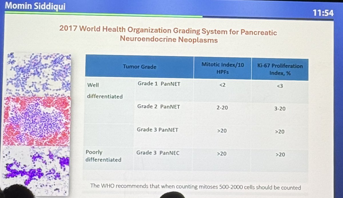 Swikrity U Baskota,MD, FCAP (@baskotacytopath) on Twitter photo Dr.Siddiqui <a href="/mtsiddi/">Momin Siddiqui</a> presenting at <a href="/cytopathology/">Cytopathology.org</a> companion meeting happening right now at #IACcongress Dr.Siddiqui <a href="/mtsiddi/">Momin Siddiqui</a> presenting at <a href="/cytopathology/">Cytopathology.org</a> companion meeting happening right now at #IACcongress