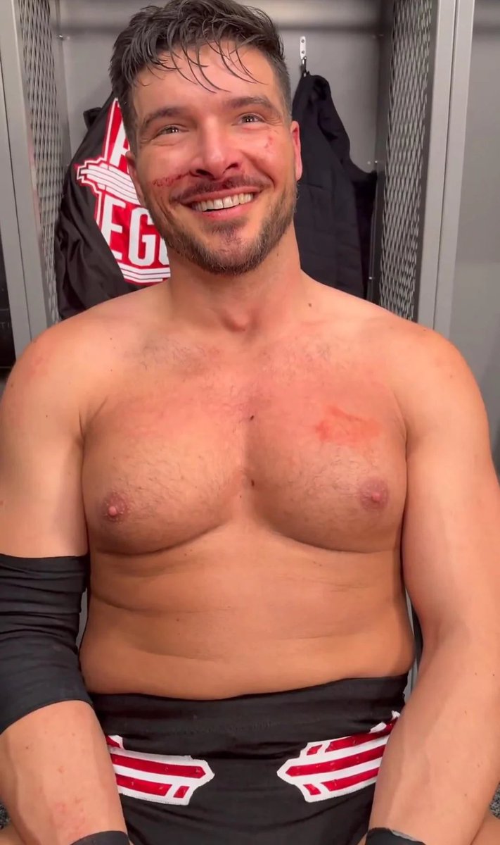 filthxparade's tweet image. this is crazy