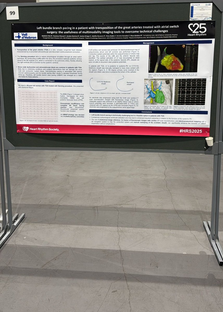 Núria Mallofré (@mallofre_n) on Twitter photo Proud to have our work featured at Heart Rhythm 2025 in San Diego 🫀⚡️🌎
#HRS2025 #EPeeps
<a href="/NRivasGandara/">Nuria</a> <a href="/J_Francisco_EP/">J.Francisco-Pascual</a> <a href="/Raquel_Adelino/">Raquel Adeliño</a> <a href="/AlbaSanor85/">Alba</a> <a href="/jordiperezrodon/">Jordi Pérez Rodón, MD, PhD</a> Proud to have our work featured at Heart Rhythm 2025 in San Diego 🫀⚡️🌎
#HRS2025 #EPeeps
<a href="/NRivasGandara/">Nuria</a> <a href="/J_Francisco_EP/">J.Francisco-Pascual</a> <a href="/Raquel_Adelino/">Raquel Adeliño</a> <a href="/AlbaSanor85/">Alba</a> <a href="/jordiperezrodon/">Jordi Pérez Rodón, MD, PhD</a>