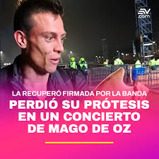 rochistico's tweet photo. @Indie5051 Lo mejor de todo es que la banda Mago de Oz, se enteró del caso y le firmaron la pierna autógrafiada! 😅😅😅 https://t.co/lr8KRIT1ax