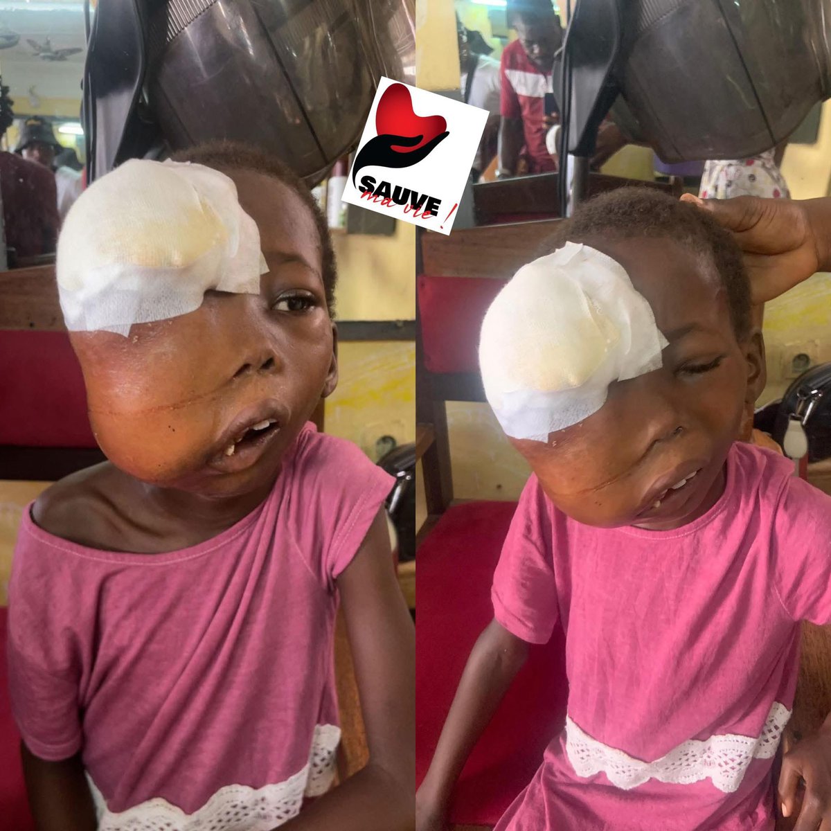 cherifmohamed_'s tweet photo. Un partage ne va strictement rien t’enlever🚨

Il nous reste 124mil pour atteindre les 600mil demandés pour les soins de Sarah.

Sauvons cet enfant ensemble famille 😭💔 donnons juste 500f🙏

Les numéros pour les dépôts sont:
Wave: +225 0708415281
Orange: +225 0758723538 https://t.co/hvXVjTzQZq
