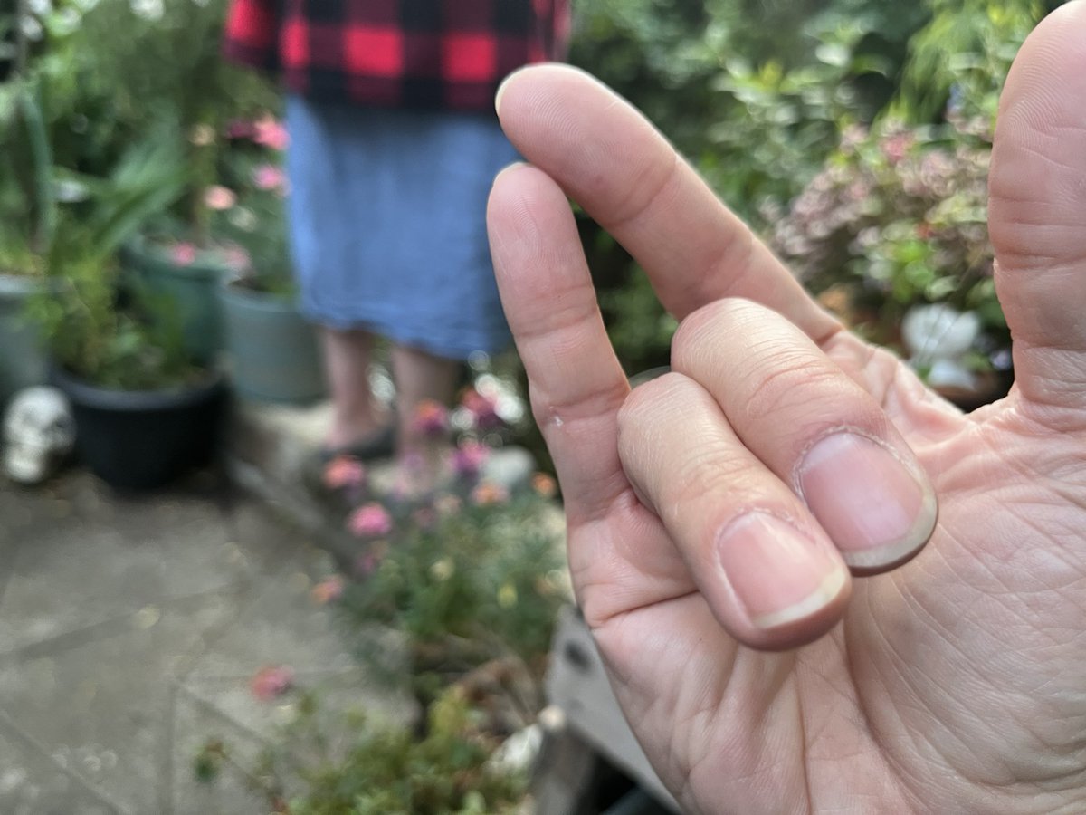 teppeikatori's tweet image. 小指と人差し指をつけるチャレンジ、逆も出来た！