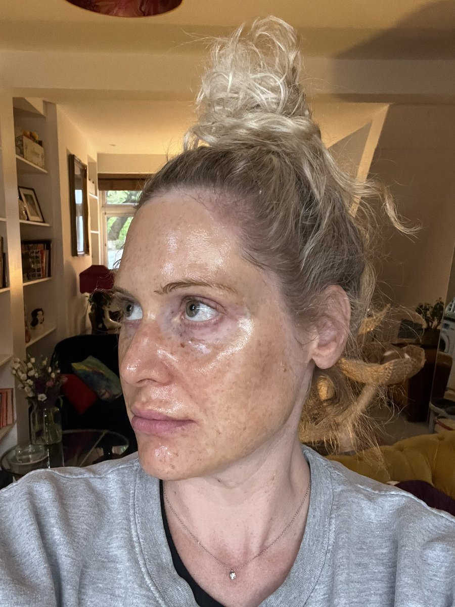 MittenDAmour's tweet photo. A woman about to realise in 20 minutes time she has a face hairier than Cheebacca’s ballsack #PeelOffMask #IYKYK https://t.co/tQSv5qhhFs