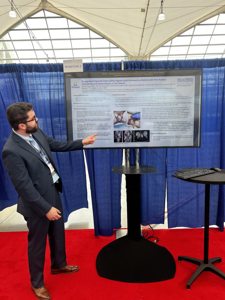 Poster 1/3: Meta-analysis comparing TAPb with Exparel versus Neuroaxial anesthesia (epidural/intrathecal) in colorectal surgery. 
Poster 2/3: Case report of strangulated sigmoid within prolapsed vaginal vault after TAH-BSO and radical cystectomy. <a href="/ASCRS_1/">ASCRS_1</a> #ASCRS2025