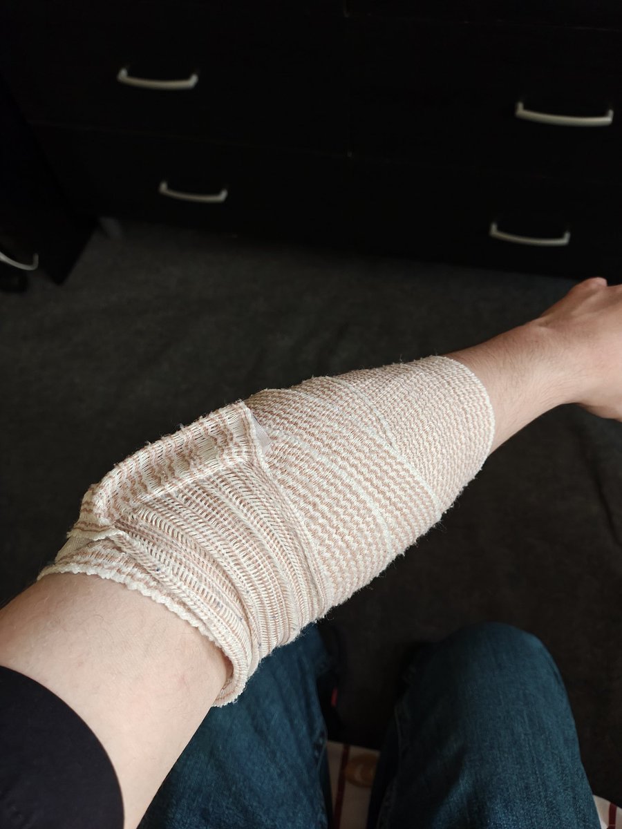 Update: came back home and my sister patched me up. I'm fine now. Thanks sis❤️