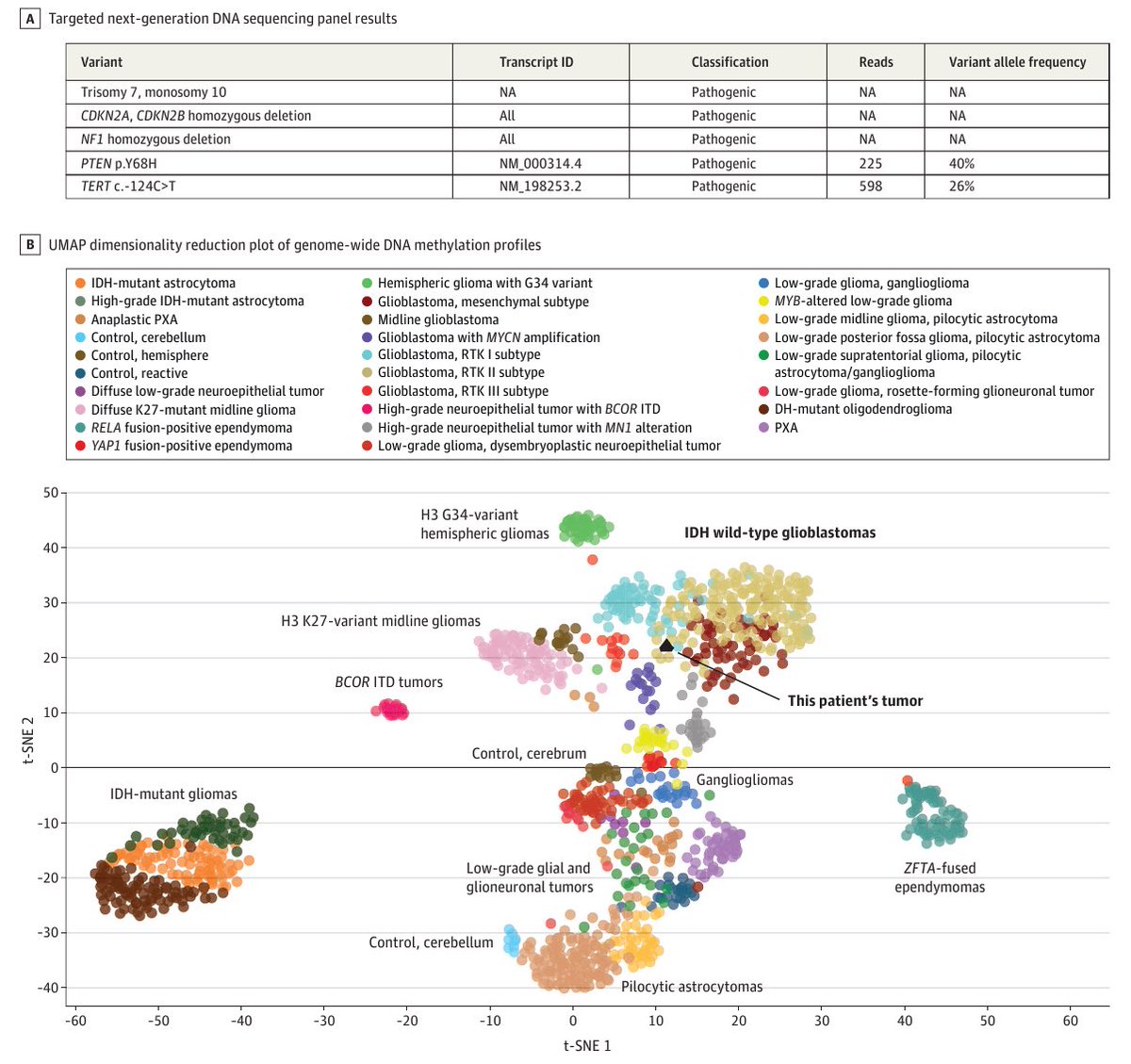 Diego A. Díaz García (@diegoadiazg) on Twitter photo 🧠 Molecular Testing for the WHO Classification of CNS Tumors.
Molecular testing is now essential for accurate CNS tumor diagnosis. Yet access remains uneven due to payer reluctance.
Routine profiling improves diagnosis, prognosis & treatment.
<a href="/JAMAOnc/">JAMA Oncology</a> 👉🏻 DOI: 🧠 Molecular Testing for the WHO Classification of CNS Tumors.
Molecular testing is now essential for accurate CNS tumor diagnosis. Yet access remains uneven due to payer reluctance.
Routine profiling improves diagnosis, prognosis & treatment.
<a href="/JAMAOnc/">JAMA Oncology</a> 👉🏻 DOI: