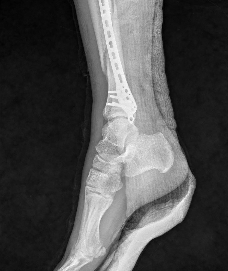 ayağı kırdık, mma ve halısahalara ikinci emre kadar ara