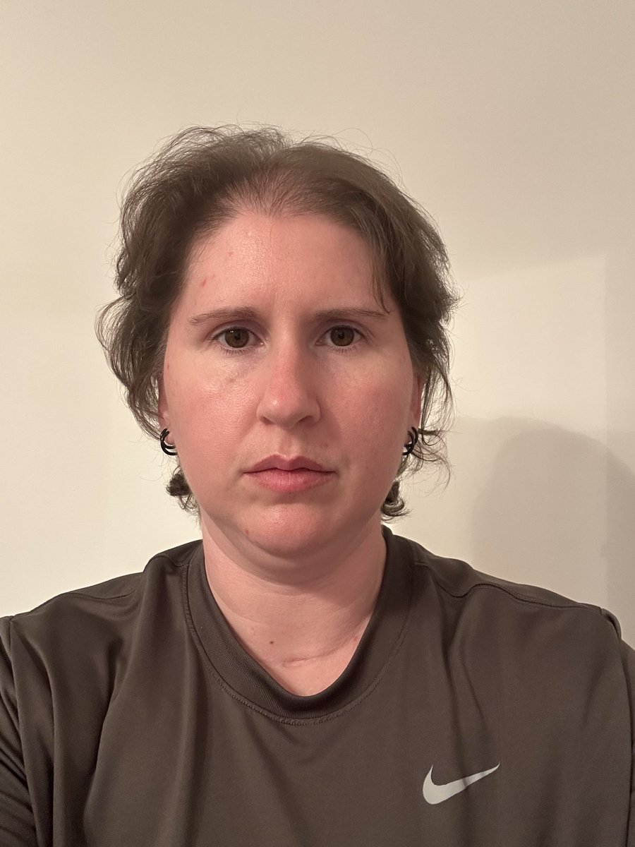 Lisa_Meints's tweet image. I’m not your inspiration. I’m a disabled person in pain, not here for applause.

If you take but never give, don’t pretend to value my work.

Leave a tip (so far, I’ve received zero):
ko-fi.com/lisameints

#ImTired #DisabledAndDiscarded #Survival #CopyrightProtected