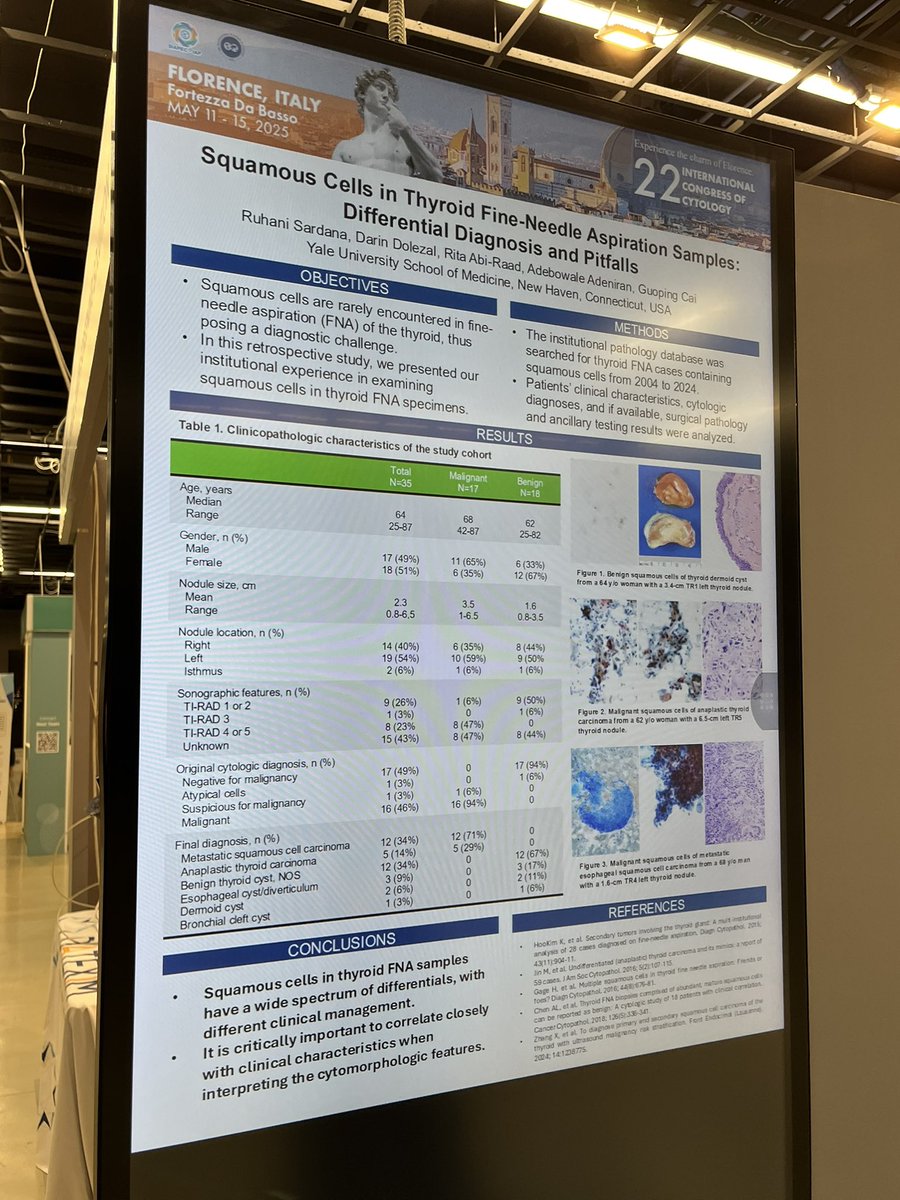 Guoping Cai, MD (@gcai1978) on Twitter photo Please check out our eposters #IACcongress 1) A validation study on Claudin 18.2 biomarker testing on gastric adenocarcinoma cytology specimens, 2) Diagnostic significance of squamous cells identified in thyroid FNA specimens. <a href="/IACytology/">International Academy Cytology</a> <a href="/yalepathology/">Yale Pathology</a> <a href="/YaleCancer/">Yale Cancer Center</a> <a href="/SIAPeC_IAP/">SIAPeC-IAP Comunicazione</a> Please check out our eposters #IACcongress 1) A validation study on Claudin 18.2 biomarker testing on gastric adenocarcinoma cytology specimens, 2) Diagnostic significance of squamous cells identified in thyroid FNA specimens. <a href="/IACytology/">International Academy Cytology</a> <a href="/yalepathology/">Yale Pathology</a> <a href="/YaleCancer/">Yale Cancer Center</a> <a href="/SIAPeC_IAP/">SIAPeC-IAP Comunicazione</a>