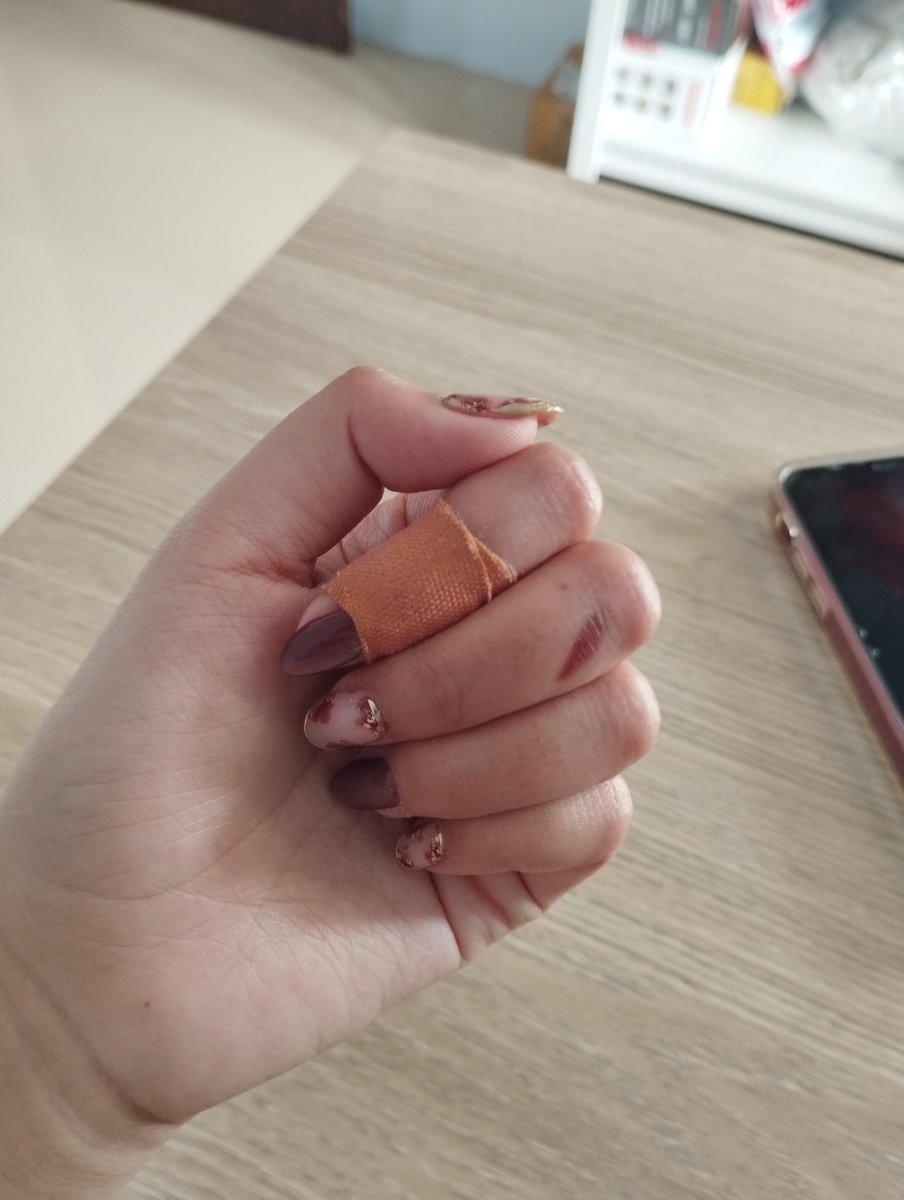 baru bbrp hari lalu kena wajan panas, dah ketambahan kena piso ajh