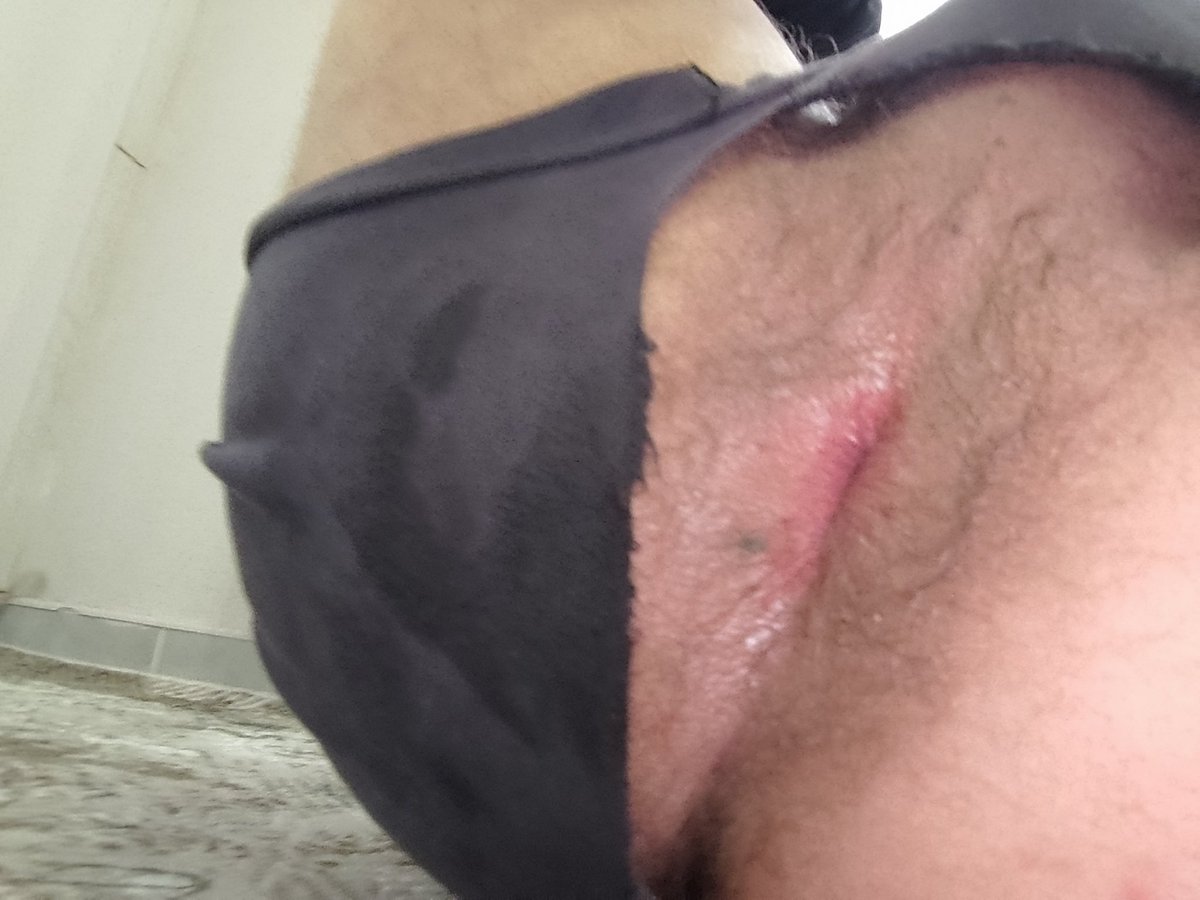 #urfagay #urfatravesti #urfaaktif #urfaseks 

Yeri Olan Aktifler Dm
