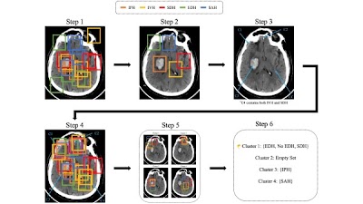 Radiology: Artificial Intelligence (@radiology_ai) on Twitter photo An uncertainty-aware #DeepLearning model to localize & classify 5 types of intracranial hemorrhage demonstrated state-of-the-art performance doi.org/10.1148/ryai.2… <a href="/Slowvak/">Brad Erickson</a> <a href="/MayoRadiology/">Mayo Clinic Radiology</a> <a href="/ShahriarFaghani/">Shahriar Faghani MD</a> #brain #uncertainty #ML An uncertainty-aware #DeepLearning model to localize & classify 5 types of intracranial hemorrhage demonstrated state-of-the-art performance doi.org/10.1148/ryai.2… <a href="/Slowvak/">Brad Erickson</a> <a href="/MayoRadiology/">Mayo Clinic Radiology</a> <a href="/ShahriarFaghani/">Shahriar Faghani MD</a> #brain #uncertainty #ML