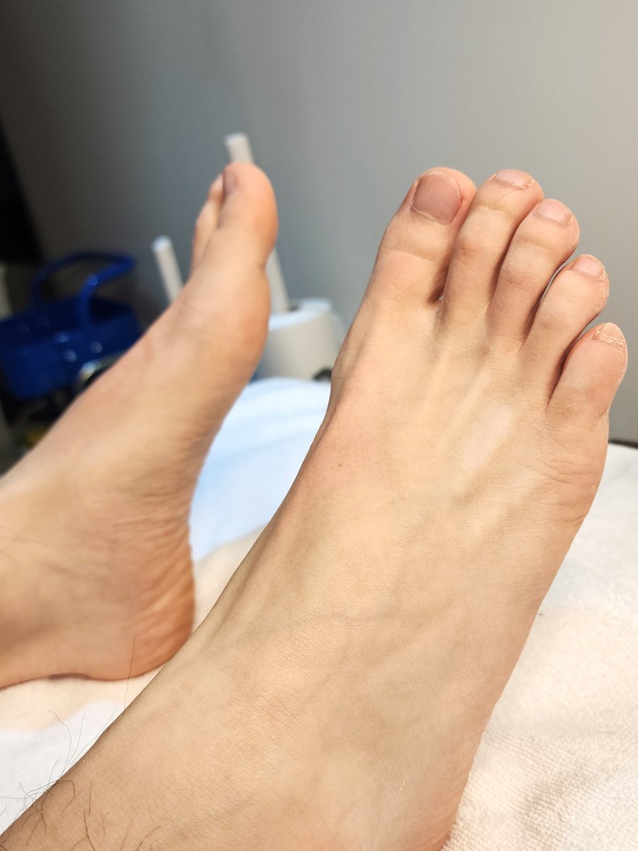 지저분한 발등 발가락NO🚫 깔끔하게💯
#남자왁싱 은 #엠엘왁싱 에서! 
📍 위치
🚇 (2,5호선)까치산역 4번 출구 도보 4분
🅿️ 건물앞 주차가능
naver.me/xHgrXphB
💠샤워실 완비
💠당일예약가능
💠1:1프라이빗 예약제
✅ 예약 방법 
💬 오픈카톡: open.kakao.com/o/sd8Qz6Kg