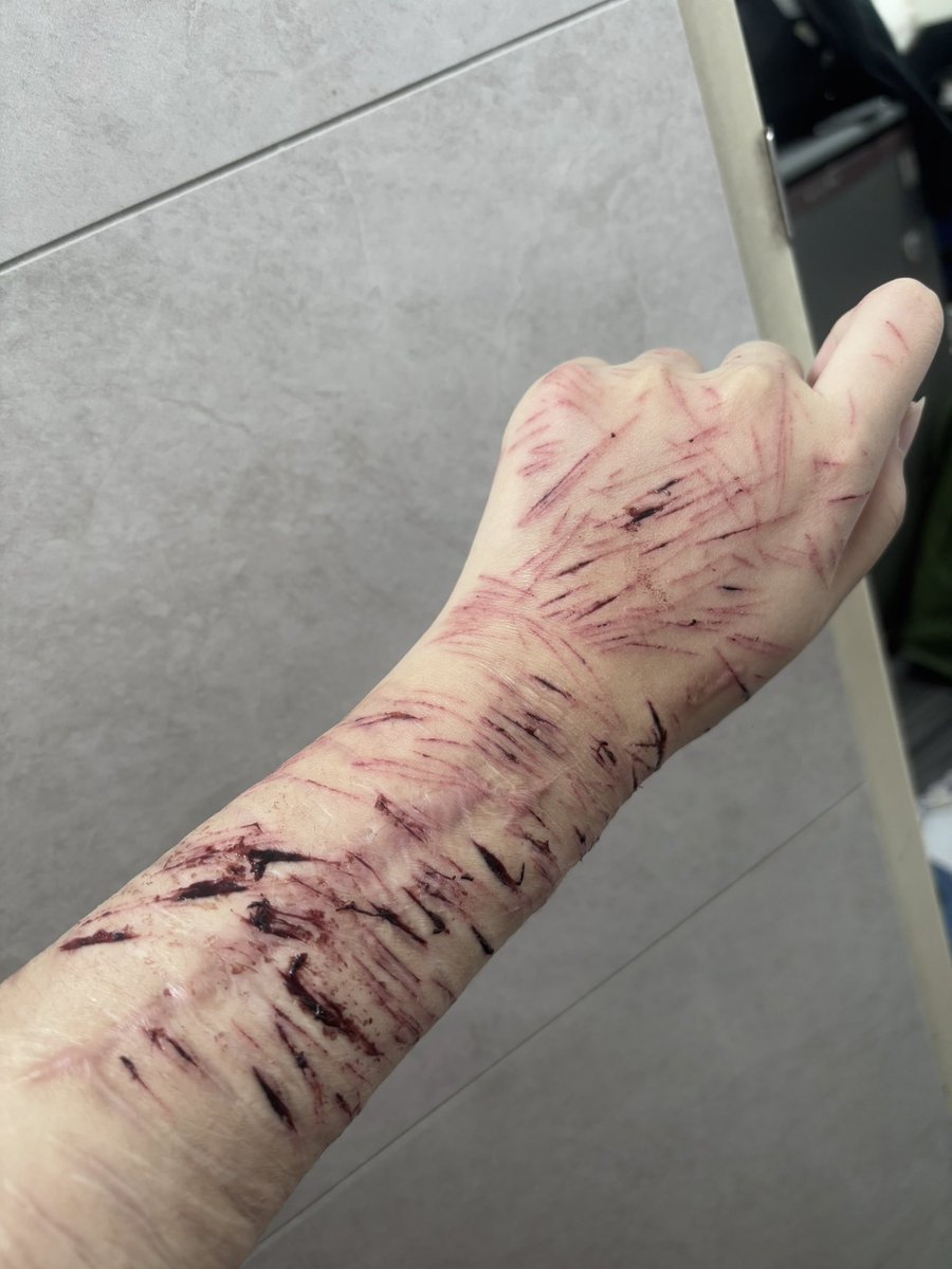 wuleeeee01's tweet photo. 這是目前得樣子 不要理我🤦🏻‍♀️🤦🏻‍♀️ https://t.co/nOCWuymkNy