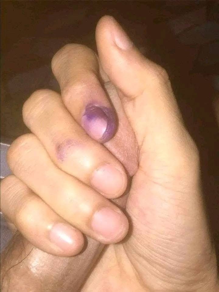 done voting 🤍