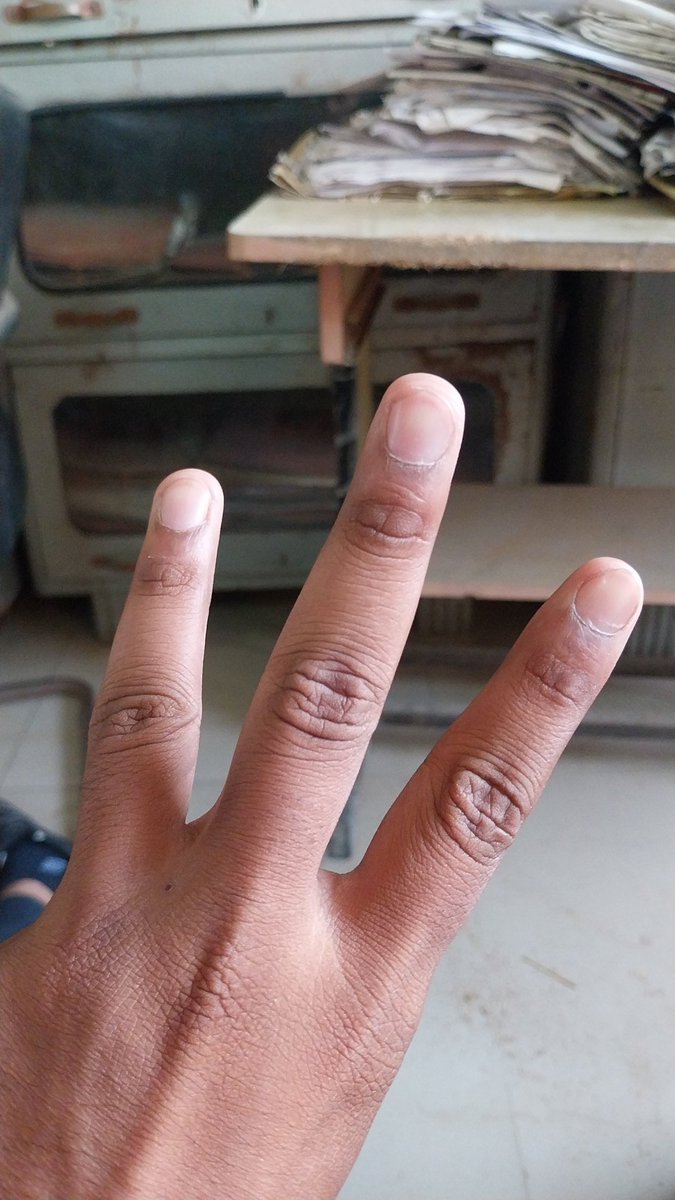 Watchers are everywhere

..

<a href="/DenetStorage/">DeNet Storage</a> <a href="/DeNetPro/">DeNet</a> #everywhere #WatchersEverywhere #watcher