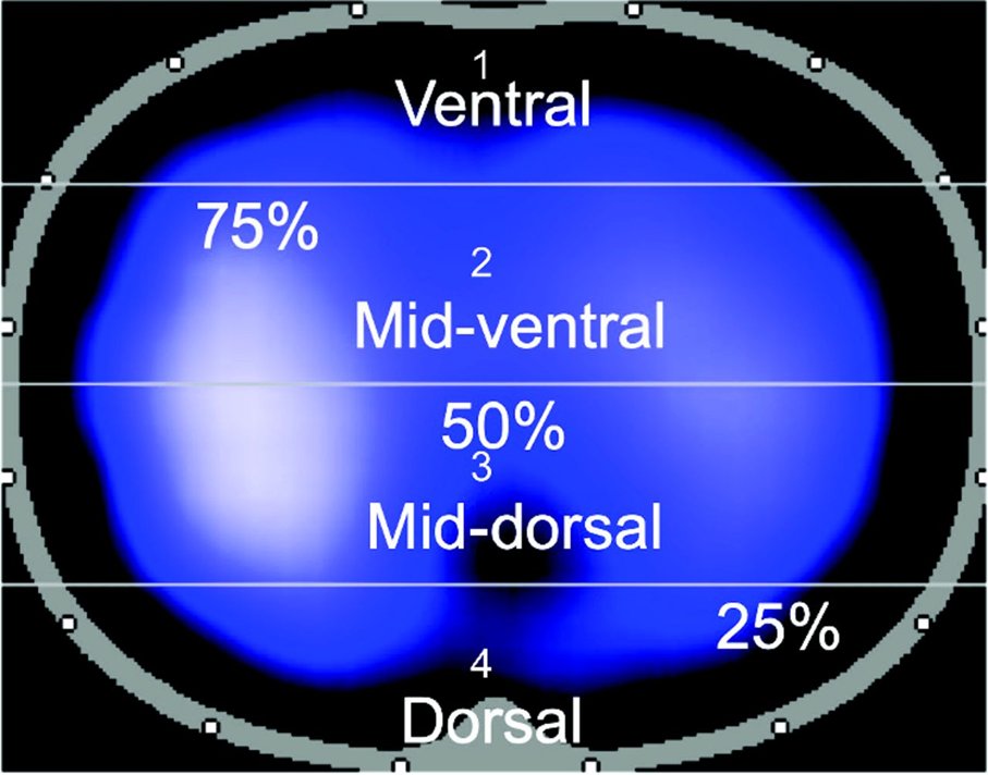RESPIRATORY CARE (@respcare) on Twitter photo Throwback Thursday, Inany et al published “Distribution of Ventilation Measured by Electrical Impedance Tomography in Critically Ill Children” from the June 2020 issue.
liebertpub.com/doi/10.4187/re… Throwback Thursday, Inany et al published “Distribution of Ventilation Measured by Electrical Impedance Tomography in Critically Ill Children” from the June 2020 issue.
liebertpub.com/doi/10.4187/re…