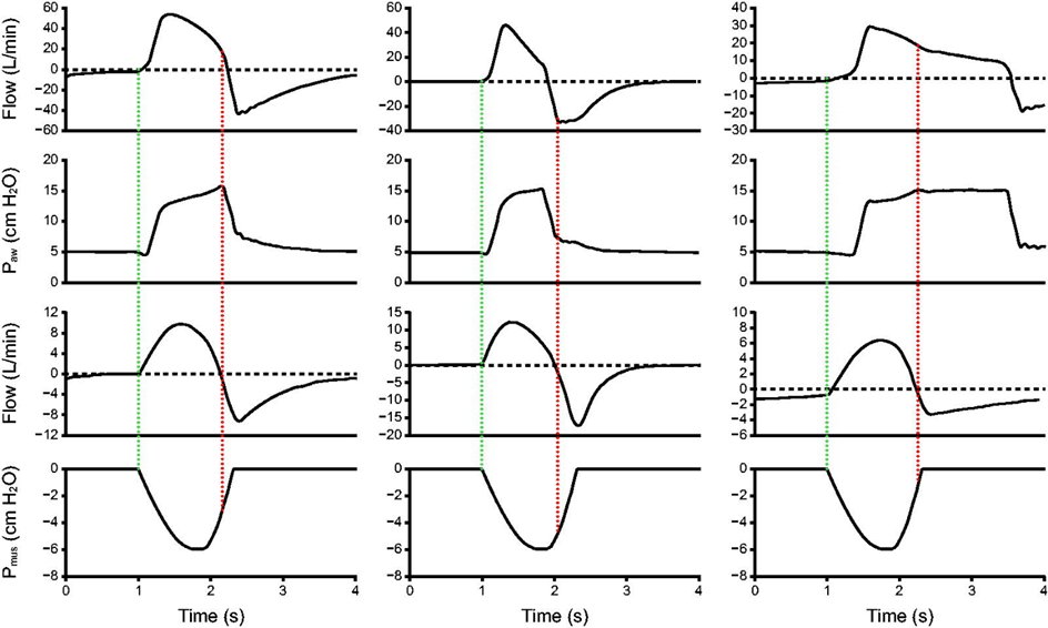 RESPIRATORY CARE (@respcare) on Twitter photo Bianchi et al performed a bench study of six ventilators during pressure support ventilation.
liebertpub.com/doi/10.1089/re… Bianchi et al performed a bench study of six ventilators during pressure support ventilation.
liebertpub.com/doi/10.1089/re…