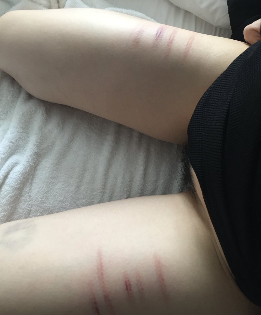 아내 앞허벅지 체벌. 아내가 앞허벅지는 너무 아파해서 거의 하지 않지만, 앞허벅지를 맞을때 내는 비명에 가까운 신음소리가 좋다.