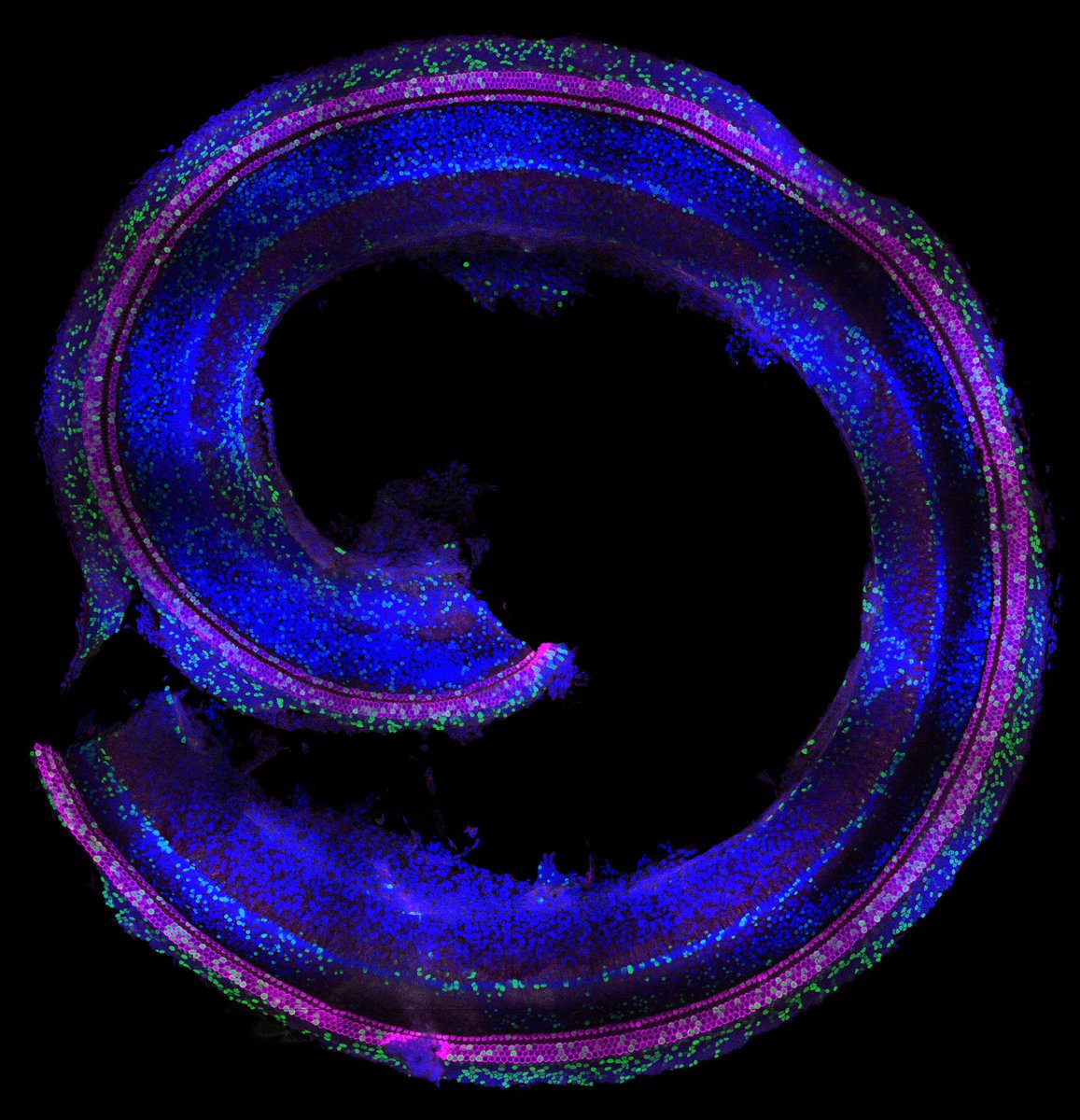 the Node (@the_node) on Twitter photo Nano Injections, Big Discoveries: The Journey to Map Neural and Inner Ear Lineages
Sandra de Haan and Jingyan He from the lab of <a href="/EmmaRAndersson/">Emma Andersson</a> tell the story behind their recent paper:
thenode.biologists.com/nano-injection… Nano Injections, Big Discoveries: The Journey to Map Neural and Inner Ear Lineages
Sandra de Haan and Jingyan He from the lab of <a href="/EmmaRAndersson/">Emma Andersson</a> tell the story behind their recent paper:
thenode.biologists.com/nano-injection…
