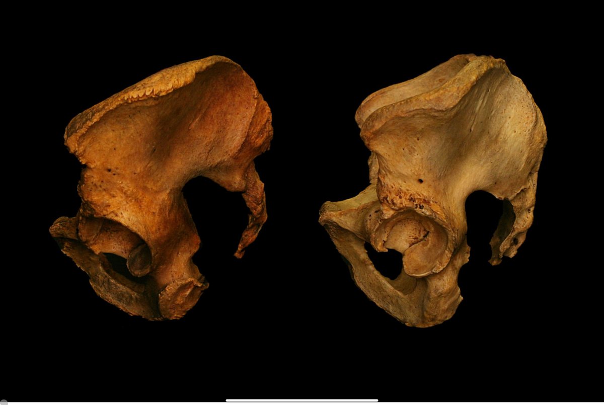 Everyone knows shoe sizes vary.

But why? 

Because bone structure is different.

Yet when it comes to exercise, we expect everyone to do the same “textbook” squats and range of motion.

How does this make sense?