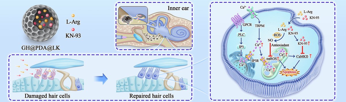 JCRnEDITORS's tweet photo. Bioadhesive drug-loaded microparticles prolong drug retention in the middle ear and ameliorate cisplatin-induced hearing loss.
| Kai Xu, Nanchang Univ. |
[Open Access]
#microparticle #bioadhesive #HearingLoss
https://t.co/cgQfvUvA6p https://t.co/BSOA94Fncy