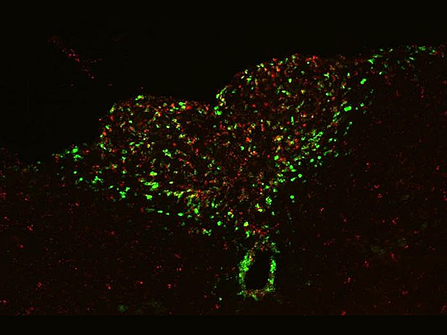 Biomedical Picture of the Day BPoD (@bpod_s) on Twitter photo Cancer muscle wasting-associated apathy is result of tumour-induced inflammation & brain circuitry interaction
📷 Xiaoyue Aelita Zhu & Sarah Starosta et al <a href="/KepecsLab/">Kepecs Lab</a> <a href="/Pignatelli_Lab/">Marco Pignatelli</a> <a href="/JanowitzTobias/">Tobias Janowitz</a>
<a href="/WashUMedNeuro/">WashU Medicine Neuroscience</a> in <a href="/ScienceMagazine/">Science Magazine</a>
➡️ bpod.org.uk/archive/2025/5… + <a href="/rooph/">Ruth Williams</a> Cancer muscle wasting-associated apathy is result of tumour-induced inflammation & brain circuitry interaction
📷 Xiaoyue Aelita Zhu & Sarah Starosta et al <a href="/KepecsLab/">Kepecs Lab</a> <a href="/Pignatelli_Lab/">Marco Pignatelli</a> <a href="/JanowitzTobias/">Tobias Janowitz</a>
<a href="/WashUMedNeuro/">WashU Medicine Neuroscience</a> in <a href="/ScienceMagazine/">Science Magazine</a>
➡️ bpod.org.uk/archive/2025/5… + <a href="/rooph/">Ruth Williams</a>