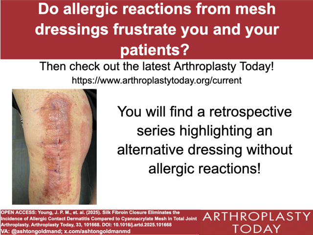 Arthroplasty Today (@arthrotoday) on Twitter photo Dressed to impress! Silk dressings had lower rate of contact dermatitis compared to mesh in this study from <a href="/HoagOrthopedic/">Hoag Orthopedic Institute</a> <a href="/robertgorab/">Robert S. Gorab</a>
Would you use it? <a href="/Bloch_ortho/">Benjamin Bloch</a> <a href="/HoganMDCraig/">Craig Hogan</a> <a href="/akinbomd/">Oluwaseun Akinbo, MD, FAAOS, FAAHKS</a>
arthroplastytoday.org/article/S2352-…
VA: <a href="/ashtongoldmanmd/">Ashton Goldman, MD, FAAOS</a> Dressed to impress! Silk dressings had lower rate of contact dermatitis compared to mesh in this study from <a href="/HoagOrthopedic/">Hoag Orthopedic Institute</a> <a href="/robertgorab/">Robert S. Gorab</a>
Would you use it? <a href="/Bloch_ortho/">Benjamin Bloch</a> <a href="/HoganMDCraig/">Craig Hogan</a> <a href="/akinbomd/">Oluwaseun Akinbo, MD, FAAOS, FAAHKS</a>
arthroplastytoday.org/article/S2352-…
VA: <a href="/ashtongoldmanmd/">Ashton Goldman, MD, FAAOS</a>