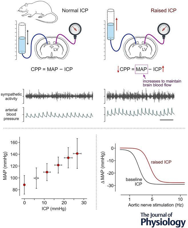 #Research by Philippa Wittenberg (<a href="/UCL_ICN/">UCL ICN</a>) et al. examines the regulation of arterial blood pressure by an intracranial #baroreceptor mechanism 🧠  💻 

📜 Read the article here: buff.ly/MgzwsCS