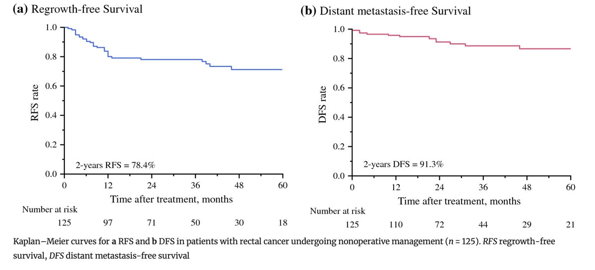 Annals of Surgical Oncology (@annsurgoncol) on Twitter photo May Issue: Risk Factors for Regrowth After Nonoperative Management for #RectalCancer
rdcu.be/elE5U
<a href="/AMVillanoMD/">Anthony Villano, MD</a>
<a href="/SyedAAhmad5/">Syed A. Ahmad</a> May Issue: Risk Factors for Regrowth After Nonoperative Management for #RectalCancer
rdcu.be/elE5U
<a href="/AMVillanoMD/">Anthony Villano, MD</a>
<a href="/SyedAAhmad5/">Syed A. Ahmad</a>
