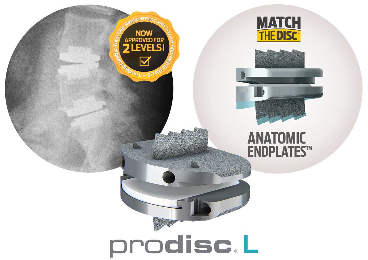 Centinel Spine (@centinelspine) on Twitter photo X Post:
The <a href="/CentinelSpine/">Centinel Spine</a> #prodiscL #TotalDiscReplacement system is a market-leading disc arthroplasty system that is clinically-proven over the long term(1) in both one & two-level lumbar procedures.
Learn why at:
centinelspine.com/prodisc_l.php
(1) Article at bit.ly/41V6l5W. X Post:
The <a href="/CentinelSpine/">Centinel Spine</a> #prodiscL #TotalDiscReplacement system is a market-leading disc arthroplasty system that is clinically-proven over the long term(1) in both one & two-level lumbar procedures.
Learn why at:
centinelspine.com/prodisc_l.php
(1) Article at bit.ly/41V6l5W.