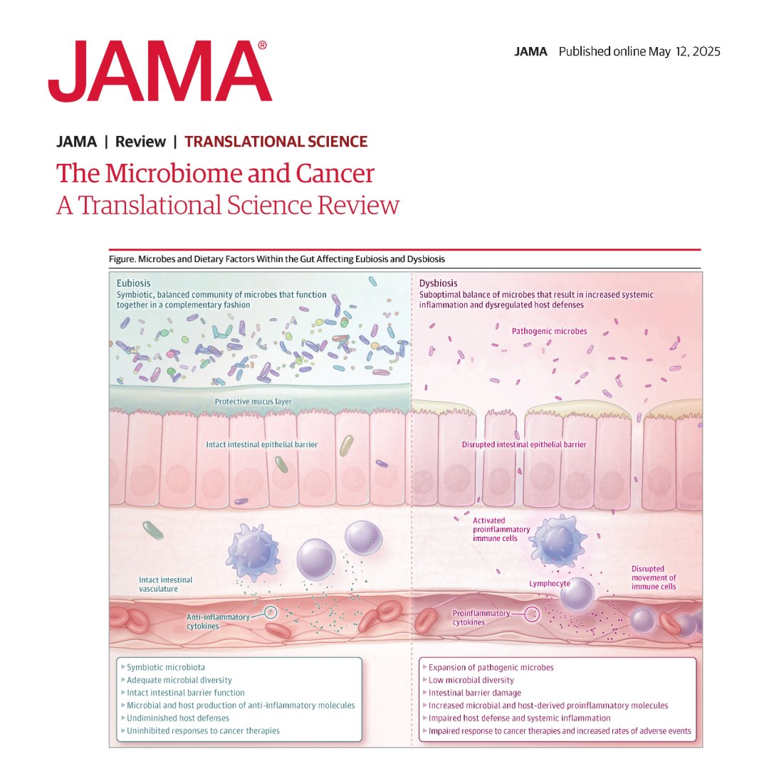 Microbes in the gut and other body locations can influence cancer development, progression, and response to treatment. 

This Review summarizes current evidence regarding the human microbiome and cancer. 

ja.ma/3Svwdjl
