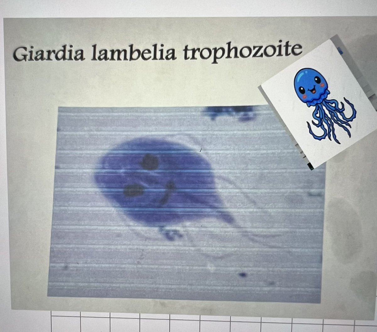 مالا تراه بالعين المجردة 🔬
بريك من المذاكرة شوي
كل شكل من هذي الأشكال وراه تشخيص واعراض مختلفة ، تسبب ضرر سواء مباشر او غير مباشر