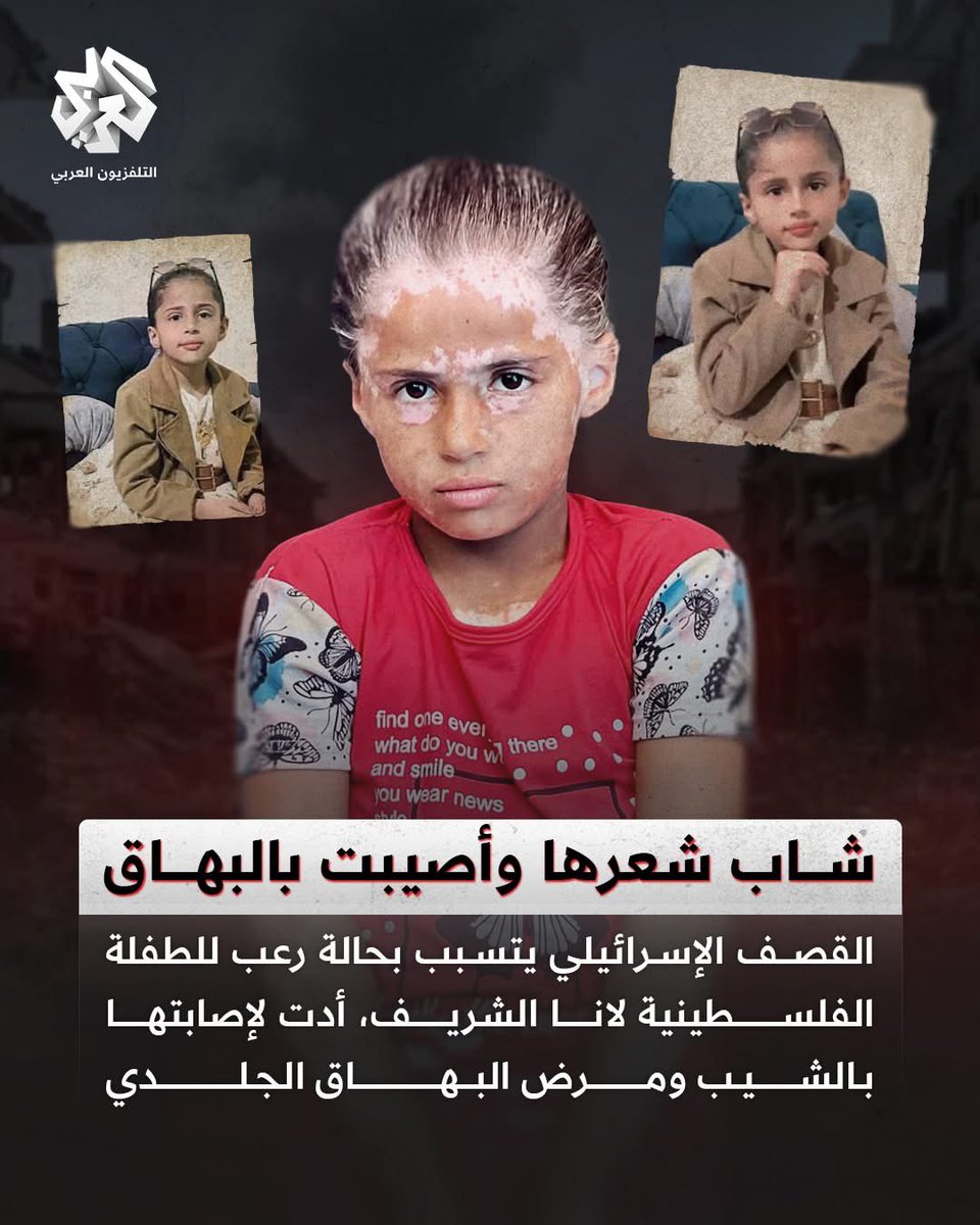 خليل القاهري (@kalkahiri) on Twitter photo صورة تُوجِع القلب،وتدميه،وتلخص حالة الذل والهوان التي تعيشها أمةُ"الخدلان"،،
<a href="/AlarabyTV/">التلفزيون العربي</a> صورة تُوجِع القلب،وتدميه،وتلخص حالة الذل والهوان التي تعيشها أمةُ"الخدلان"،،
<a href="/AlarabyTV/">التلفزيون العربي</a>