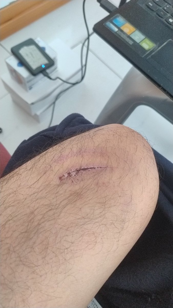 🚨Gracias a qué me cuido y cuido a mis sumisos con la lealtad de siempre y usando poncho hoy estoy en MURCIA 
...La aventura  recién empieza pero cuesta , dolor y esfuerzo ... Se acabaron las vacaciones, otra ves a montar culos