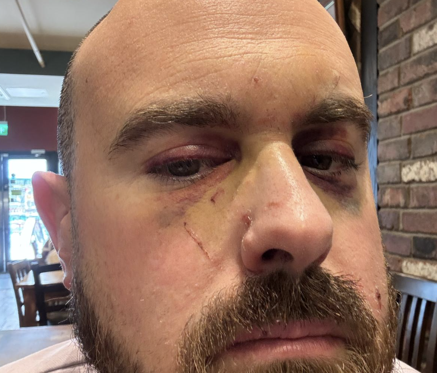 A West Mercia Police Federation member is calling for tougher sentences for offenders who attack police officers.

Read PC Mike Poultney's full story online in the latest West Mercia Police Federation branch magazine: bit.ly/4jRQoUV