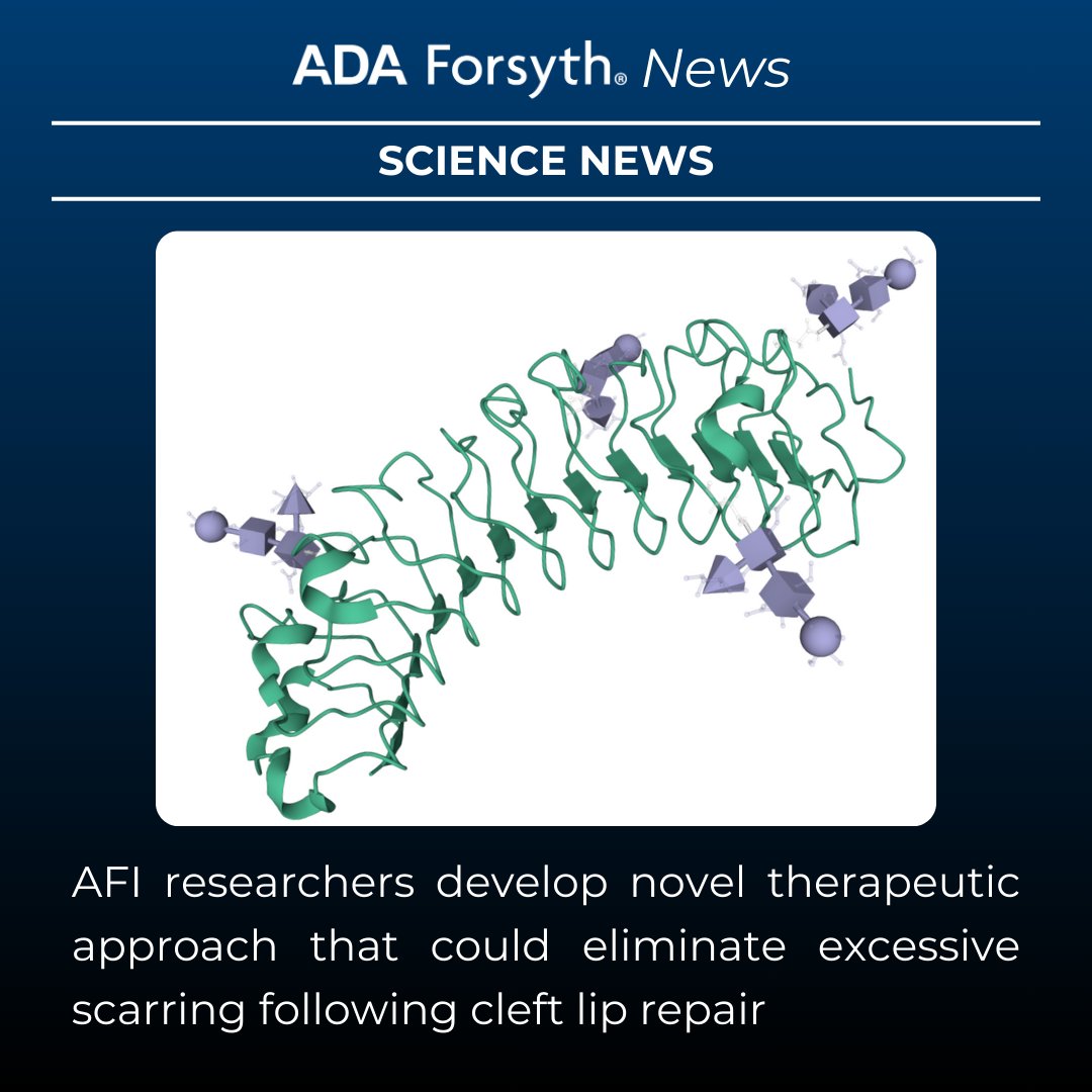 ForsythResearch's tweet image. Research being conducted by scientists at ADA Forsyth highlights how fibromodulin may help prevent thick scarring after cleft lip/palate surgery. This innovative study is co-led by AFI adjunct faculty Dr. Eric Kang Ting. Read the full press release here: forsyth.org/novel-therapeu…