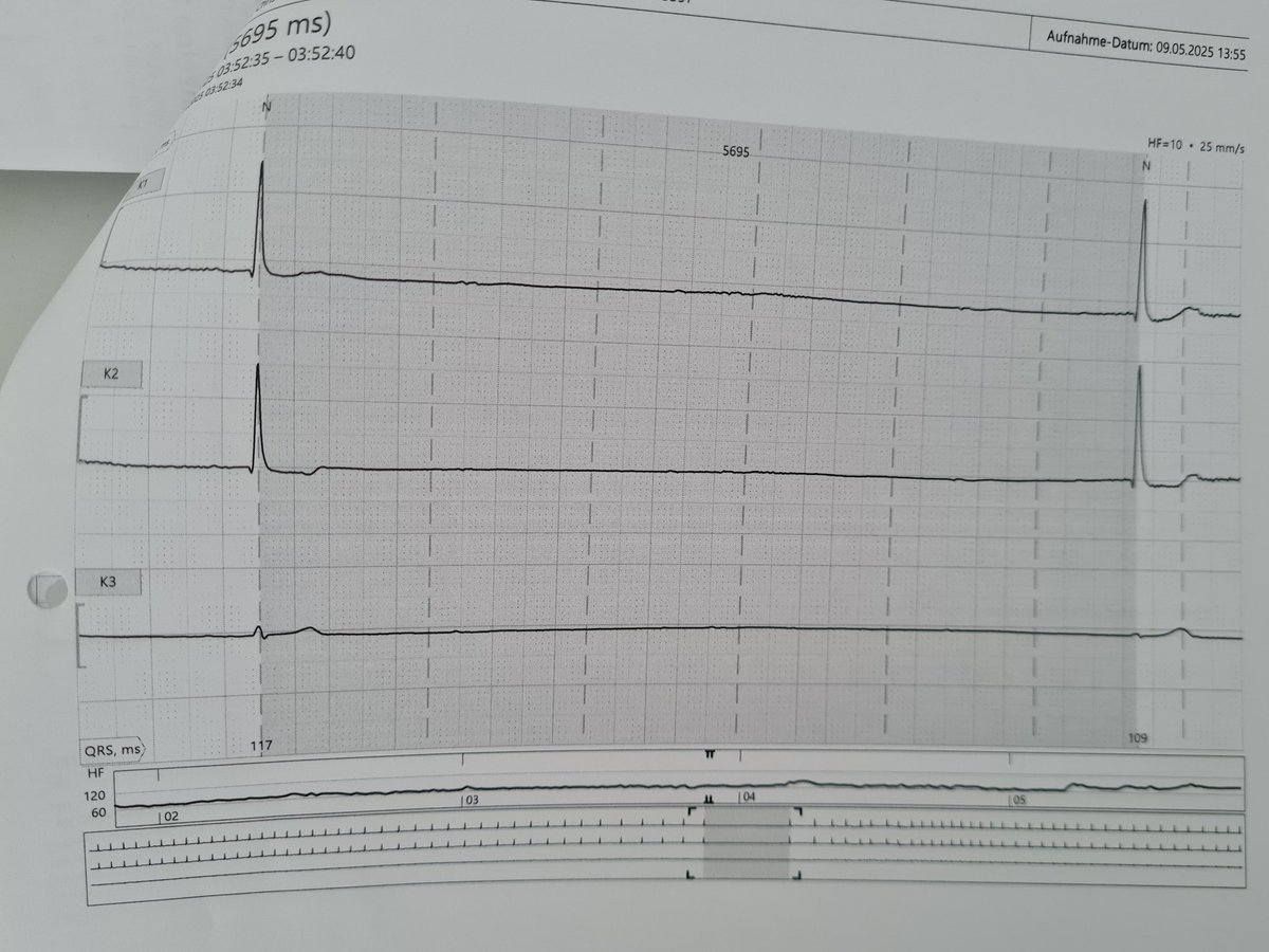 The patient is 180cm tall and weighs 130kg.
It is 03:52 a.m. He's sleeping.
What would you do?