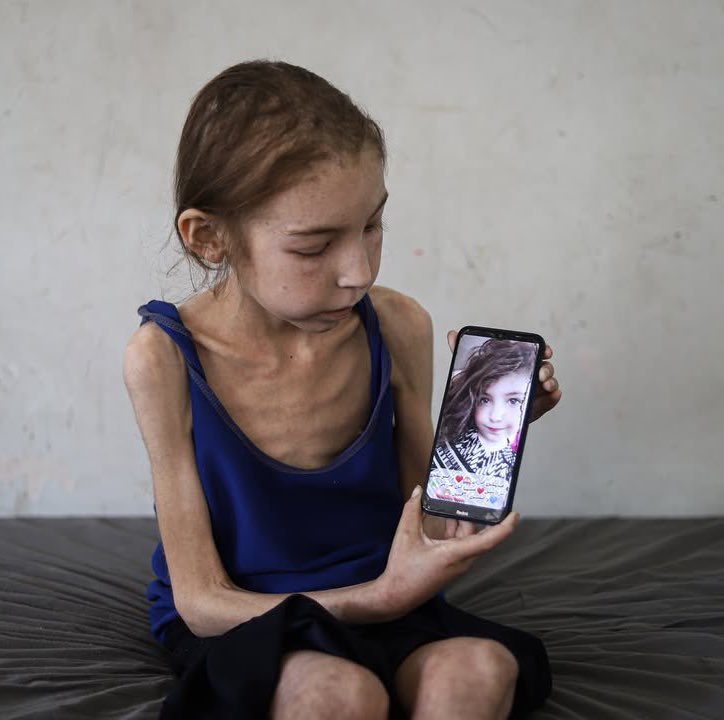 yousef_ki1's tweet image. Her name is Rahaf, she is starving.