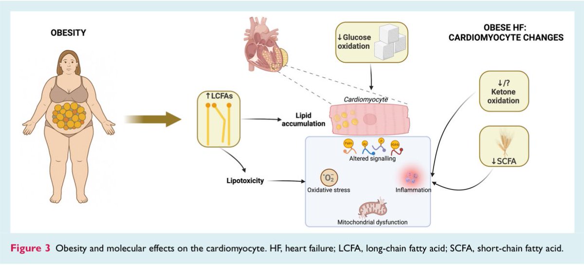 Giuseppe Galati (@giuseppegalati_) on Twitter photo 🔥 #HF & #Obesity
#HFA <a href="/escardio/">European Society of Cardiology</a> statement
#HFUA
A further recognition of the #CaReMeLO
area importance ❤️🔥
<a href="/EJHFEiC/">EJHF Editor-in-Chief</a> <a href="/MicheleEmdin/">Michele Emdin</a>
<a href="/AndrewJSauer/">Andrew J Sauer MD</a> <a href="/gcfmd/">Gregg Fonarow MD</a> <a href="/DrRajivsankar/">Dr.Rajiv Sankaranarayanan</a> <a href="/ShelleyZieroth/">Shelley Zieroth</a> <a href="/DrMarthaGulati/">Dr. Martha Gulati ♥️🫀❤️🩹🇨🇦</a> <a href="/JavedButler1/">Javed Butler</a> <a href="/GianluSava/">Gianluigi Savarese</a> <a href="/iamritu/">Ritu Thamman MD</a> <a href="/HFA_President/">HFAPresident</a>
bit.ly/3GPOfuc 🔥 #HF & #Obesity
#HFA <a href="/escardio/">European Society of Cardiology</a> statement
#HFUA
A further recognition of the #CaReMeLO
area importance ❤️🔥
<a href="/EJHFEiC/">EJHF Editor-in-Chief</a> <a href="/MicheleEmdin/">Michele Emdin</a>
<a href="/AndrewJSauer/">Andrew J Sauer MD</a> <a href="/gcfmd/">Gregg Fonarow MD</a> <a href="/DrRajivsankar/">Dr.Rajiv Sankaranarayanan</a> <a href="/ShelleyZieroth/">Shelley Zieroth</a> <a href="/DrMarthaGulati/">Dr. Martha Gulati ♥️🫀❤️🩹🇨🇦</a> <a href="/JavedButler1/">Javed Butler</a> <a href="/GianluSava/">Gianluigi Savarese</a> <a href="/iamritu/">Ritu Thamman MD</a> <a href="/HFA_President/">HFAPresident</a>
bit.ly/3GPOfuc