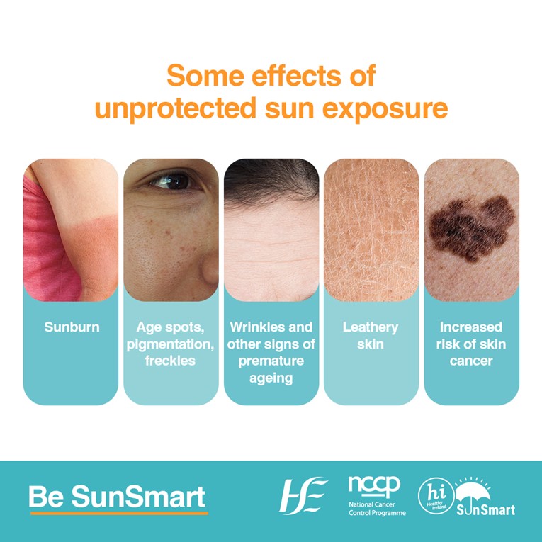 Without sun protection you are leaving your skin exposed to UV radiation from the sun. This can cause sunburn, skin ageing such as wrinkles, age spots, eye damage and skin cancer. Be #SunSmart and protect your skin from the sun, visit bit.ly/46nRyBv