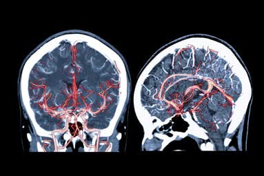 The Stroke Council's Early Career Committee is hosting a series of Professional and Career Development webinars in May. #StrokeMonth

How to be a Good Mentor and Mentee
12PM CT on May 23, 2025

To register and view upcoming webinars, visit: ahajrnls.org/3RvCU4v