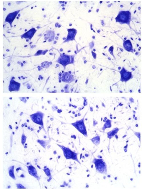 RNA Therapeutics Institute (@rti_umasschan) on Twitter photo Hot off the press from the Khvorova & Brown labs <a href="/UMassChan/">UMass Chan Medical School</a>
RNAi-mediated silencing of SOD1 profoundly extends survival and functional outcomes in ALS mice
cell.com/molecular-ther… #RNA #RNATherapeutics Hot off the press from the Khvorova & Brown labs <a href="/UMassChan/">UMass Chan Medical School</a>
RNAi-mediated silencing of SOD1 profoundly extends survival and functional outcomes in ALS mice
cell.com/molecular-ther… #RNA #RNATherapeutics