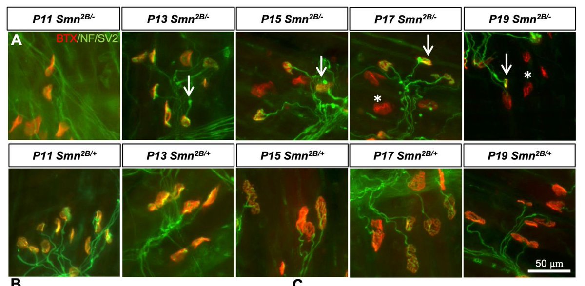 journal_nd's tweet image. From our latest issue 🆕 research from @uottawa demonstrating peripheral effects before motor neuron loss in the #SMA 2B/- mouse model. Read the #openaccess paper here: buff.ly/51H530o #spinalmuscularatrophy #neuromuscularjunction