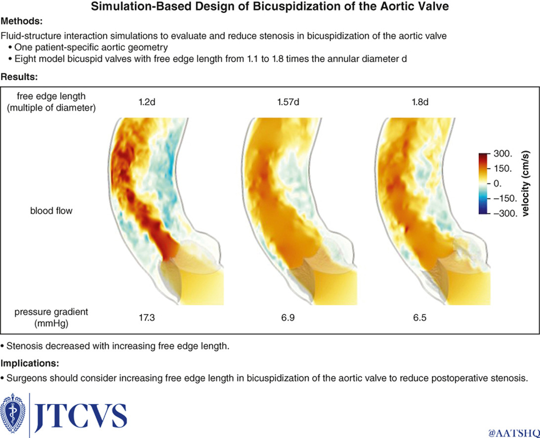 AATS (@aatshq) on Twitter photo #TrendingTuesday: The #21 most read AATS Journals article from 2024 is on a simulation-based design of bicuspidization of the #aortic valve. Read this study in #JTCVS: doi.org/10.1016/j.jtcv…
#AortaEd <a href="/MoussaHaidarMD/">Moussa Haidar</a> <a href="/perryschoi/">Perry S. Choi, MD</a> <a href="/stanfordctsurg/">Stanford Cardiothoracic Surgery</a> #TrendingTuesday: The #21 most read AATS Journals article from 2024 is on a simulation-based design of bicuspidization of the #aortic valve. Read this study in #JTCVS: doi.org/10.1016/j.jtcv…
#AortaEd <a href="/MoussaHaidarMD/">Moussa Haidar</a> <a href="/perryschoi/">Perry S. Choi, MD</a> <a href="/stanfordctsurg/">Stanford Cardiothoracic Surgery</a>