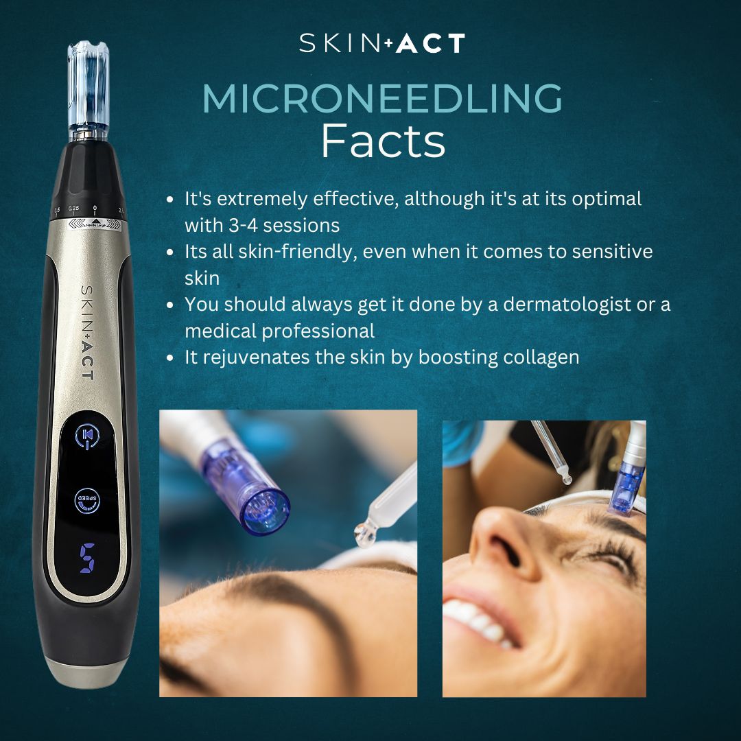 spaandequipment's tweet image. Want radiant skin? ✨ Microneedling boosts collagen, rejuvenates, and is safe for all skin types—even sensitive! Best results in 3-4 sessions. Always trust a #dermatologist or licensed pro for the treatment! #skincare  #spaequipment #spalife #estheticianlife #luxuryspa #selfcare