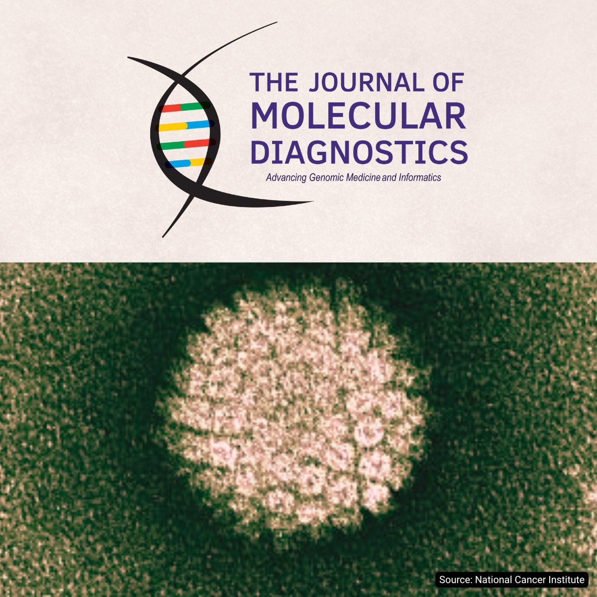 Association for Molecular Pathology (@ampath) on Twitter photo The FDA just approved the first at-home test for HPV. ICYMI, here's a recent #OpenAccess article in <a href="/JMDiagn/">The Journal of Molecular Diagnostics</a> about how well those self-collected swabs hold up, including under extreme conditions.
🔗 jmdjournal.org/article/S1525-… The FDA just approved the first at-home test for HPV. ICYMI, here's a recent #OpenAccess article in <a href="/JMDiagn/">The Journal of Molecular Diagnostics</a> about how well those self-collected swabs hold up, including under extreme conditions.
🔗 jmdjournal.org/article/S1525-…