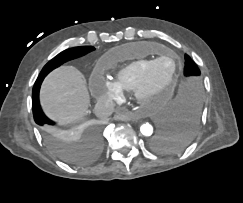 Elliot K Fishman / CTisus.com tweet media